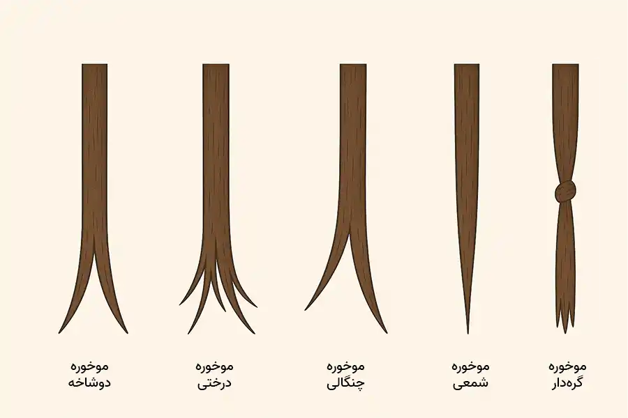 انواع موخوره